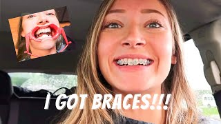 FINALLY GETTING BRACES ON VLOG 2023 [upl. by Krissy636]