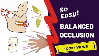 Balanced Occlusion Made Easy  PROSTHODONTICS [upl. by Enajyram540]