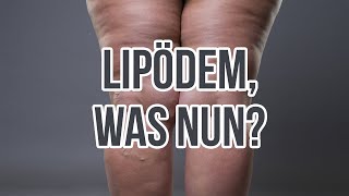 Diagnose LipÃ¶dem Was jetzt [upl. by Assenal]