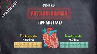 O QUE É A ARRITMIA CARDÍACA [upl. by Kerrin619]