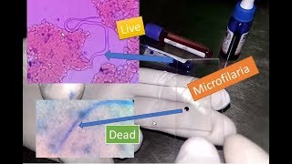 Microfilaria live and dead under Microscope [upl. by Ahsiram370]