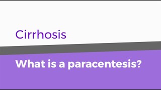 Cirrhosis – What is a paracentesis [upl. by Ramirol246]