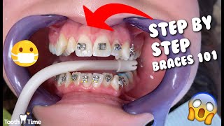 Dental Braces  Step by Step  Tooth Time Family Dentistry New Braunfels [upl. by Bea]