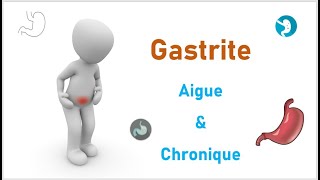 Gastrite Aiguë amp Chronique 🤢  HépatoGastroEntérologie [upl. by Nanon]