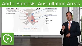 Ascending Aortic Aneurysm A HighRisk Area Close to the Heart [upl. by Hpotsirhc]