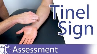 Tinel Sign Wrist  Carpal Tunnel Syndrome Diagnosis [upl. by Nailil]