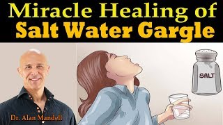 Miracle Healing of Salt Water Gargle  Dr Alan Mandell DC [upl. by Ovatsug]