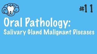 Oral Pathology  Salivary Gland Malignant Diseases  INBDE ADAT [upl. by Rutherfurd]