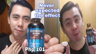 3 CORRECT TIPS HOW TO USE POVIDONE IODINE BETADINE GARGLE FOR SORE THROAT RELIEF  HONEST REVIEW [upl. by Sukey]