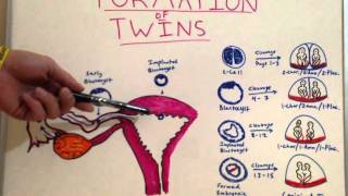 Formation of Twins  Embryology Video for Medical Students  USMLE Step 1 [upl. by Aleda]