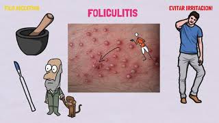 TRATAMIENTO PARA LA FOLICULITIS [upl. by Emiatej]