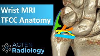 MRI Anatomy of TFCC [upl. by Kavanaugh322]