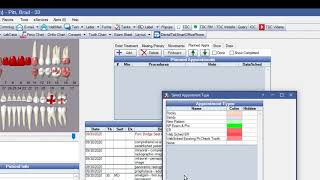 Open Dental Scheduling with Appointment Types [upl. by Einnus]