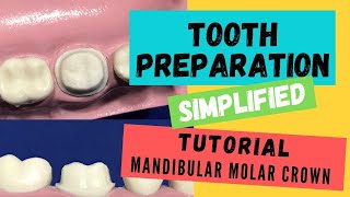 Zirconia Crown Preparation DEMONSTRATION Super Simplified [upl. by Doble]