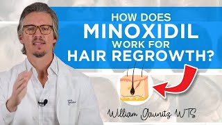 Minoxidil How Does Minoxidil Work For Hair Regrowth Results  Trichologist William Gaunitz [upl. by Addia]