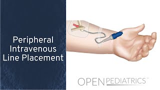 Peripheral Intravenous Line Placement by B Johnson L DelSignore  OPENPediatrics [upl. by Kooima]