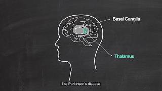 Thalamic Mechanism of Parkinson Disease [upl. by Dewain143]