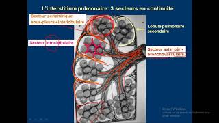 syndrome interstitiel en détails 01 [upl. by Chatwin]