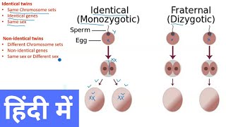 Types of Twins in Hindi [upl. by Ozneral]