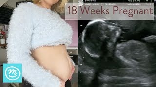 18 Weeks Pregnant What You Need To Know  Channel Mum [upl. by Seuqramed765]