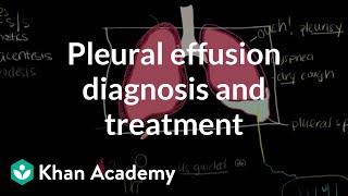 Pleural effusion diagnosis and treatment  Respiratory system diseases  NCLEXRN  Khan Academy [upl. by Aneelas]