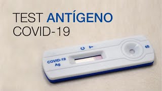 Test Antígeno COVID19 Clínica CEMTRO [upl. by Aloz5]