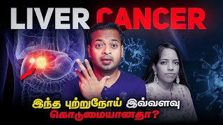 4 Early Signs Of Cancer Tamil [upl. by Aynodal]