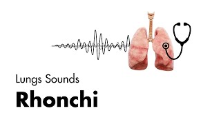 Rhonchi  Lung Sounds  Medzcool [upl. by Rebma]