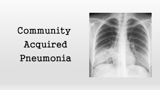 Community Acquired Pneumonia [upl. by Nicholson906]