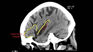 Introduction to Brain Surface Anatomy [upl. by Putnem]