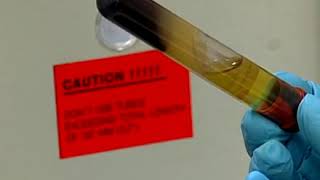 Preparing a serum specimen using a serum separator tube [upl. by Wilinski]