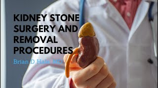 How to Pass A Kidney Stone Within 24 Hours [upl. by Schrader]