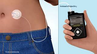 What is an insulin pump [upl. by Selle]