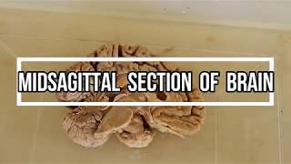 Midsagittal Section of Brain  neuroanatomy [upl. by Nwahsel]