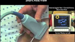 Ultrasound Pericardiocentesis and TTE Training Model [upl. by Philoo]