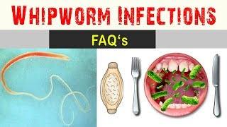 Whipworm infections  Frequently Asked Questions And Answers [upl. by Boarer]