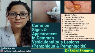 Signs in common Vesiculobullous Lesions Pemphigus amp Pemphigoids [upl. by Mark]