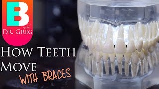 BRACES EXPLAINED How Teeth Move  Braces Work [upl. by Neisa]