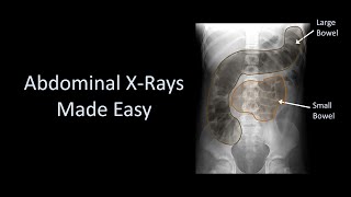 How to Read Dental XRays [upl. by Intruok]