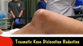 dislocated knee or patella [upl. by Kabob]