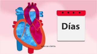 Persistencia de Conducto Arterioso [upl. by Thornton]