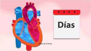 CONDUCTO ARTERIOSO PERSISTENTE PDA CLASICO ID SEDICARVET 7 [upl. by Bayer393]