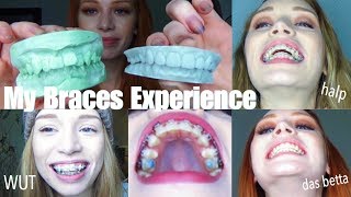 3 YEARS OF BRACES IN UNDER 30 MINS  VLOGstyle experience  transformation quotglowupquot [upl. by Grochow588]