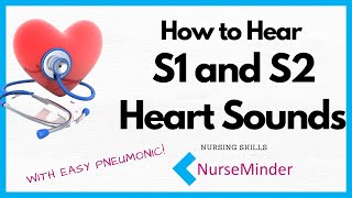 How to Hear S1 and S2 Heart Sounds [upl. by Catima]