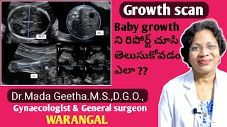 8 month pregnancy scan report Foetal growth scan in Telugu 32 weeks pregnancy scanDrMada Geetha [upl. by Minton84]