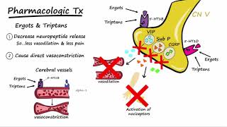 Migraines  Pathophysiology amp Treatment Described Concisely [upl. by Aihsemot]