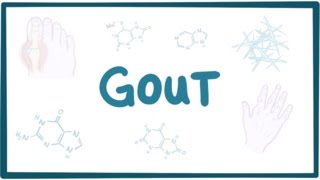 Gout  causes symptoms diagnosis treatment pathology [upl. by Zacherie]