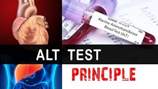 ALT Test Principle  Clear Explain [upl. by Ymmij]