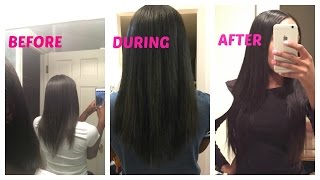 BIOTIN REVIEW BEFORE AND AFTER [upl. by Uria]