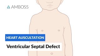 Ventricular Septal Defect VSD  Heart Auscultation  Episode 11 [upl. by Chilt955]